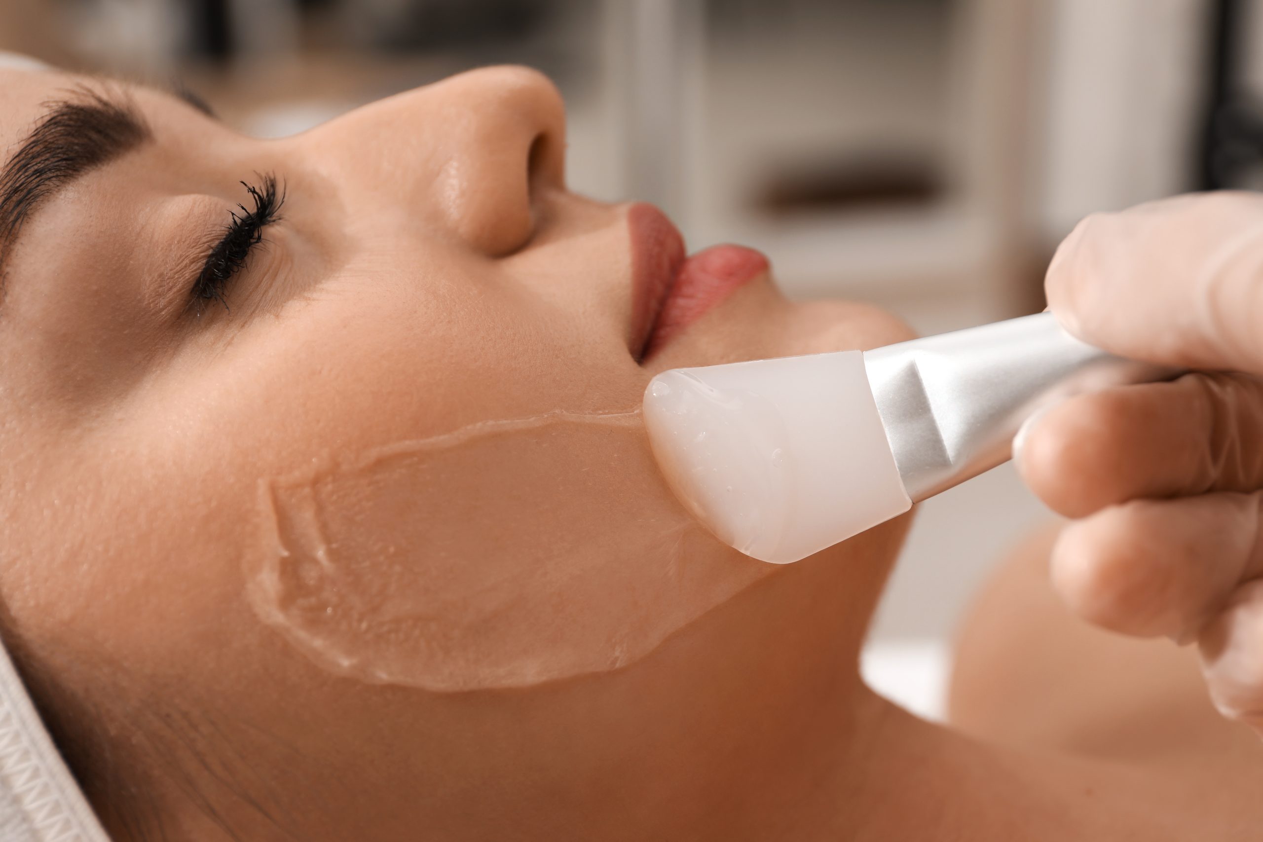 Everything that You Need to Know about Chemical Peels