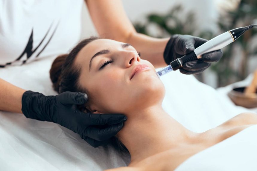 Professional Microneedling Treatment for Softer, Younger-Looking Skin