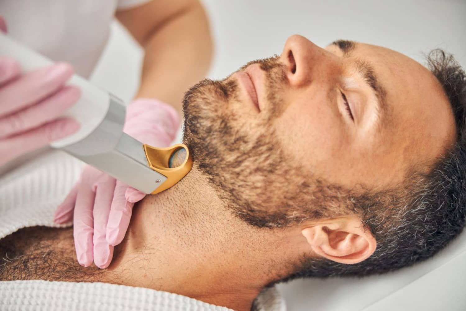 4 Benefits of Laser Hair Removal for Men at Our Med Spa