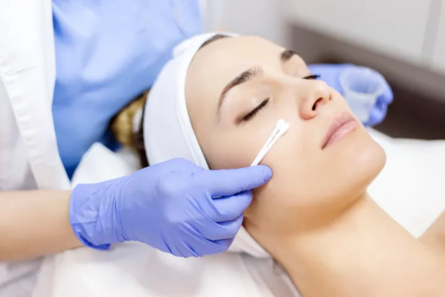 5 Ways Chemical Peels Can Improve Your Appearance