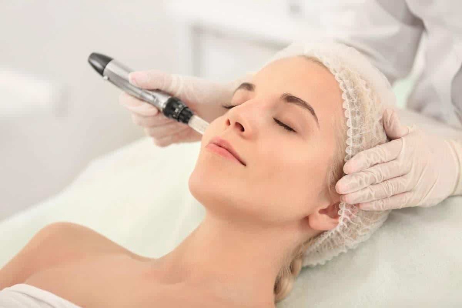 Benefits of Microneedling in Newnan and Columbus